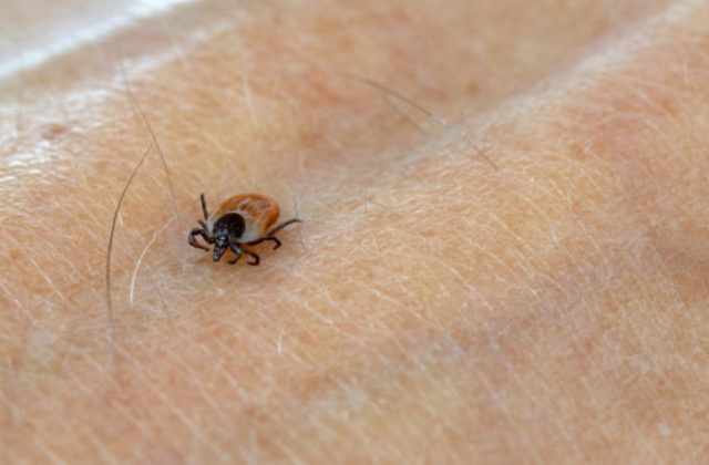 Každý piaty pacient dostal kliešťovú encefalitídu bez toho, aby si našiel na tele kliešťa!&hellip;