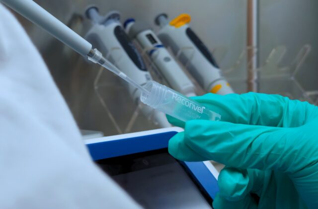 Nízkomolekulové prírodné extrakty s obsahom peptidov ukazujú nádej…