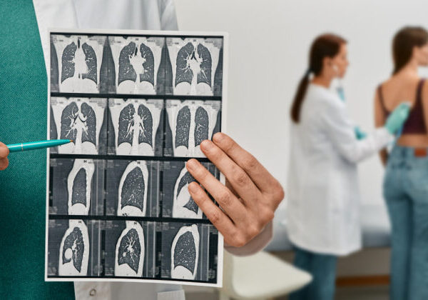 Pľúcna fibróza: Strach z diagnózy nesmie zostať bez slov