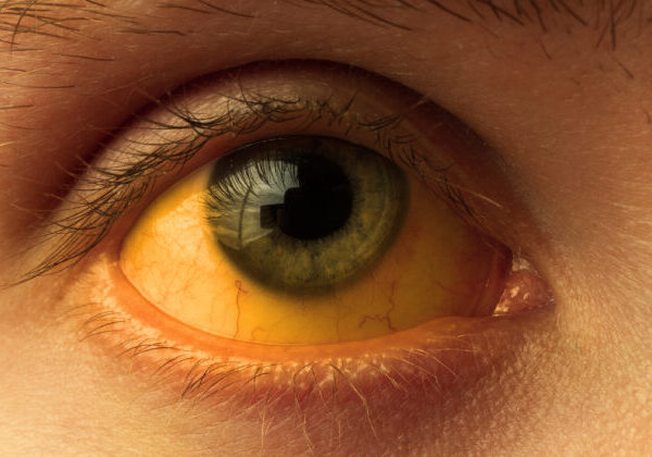 Vyhnite sa cestám do Česka, varuje poľský rezort zahraničia