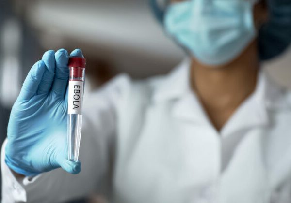 Európski ministri zdravotníctva budú v piatok mimoriadne rokovať o šírení eboly